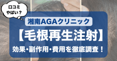 【毛根再生注射の口コミはやばい？】湘南AGAクリニックでの効果・副作用・費用を徹底調査