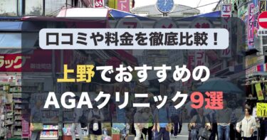 上野のAGA治療が人気のおすすめAGAクリニック9選！薄毛治療の料金や口コミを徹底比較